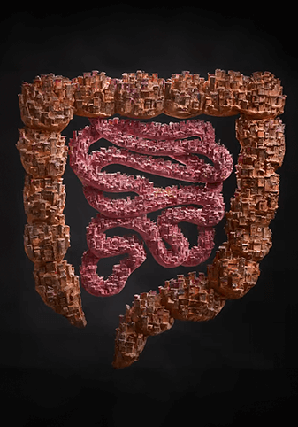 Slums For Worms
